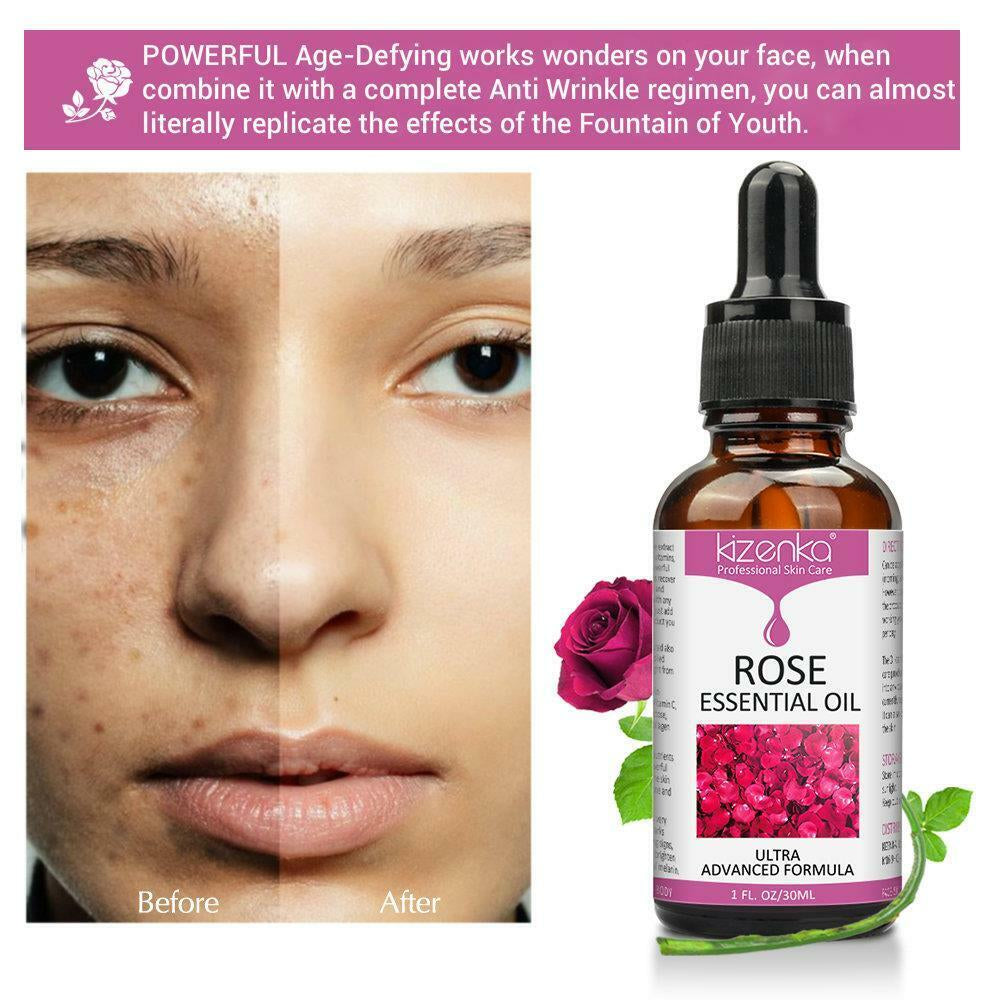 Kizenka Natural Anti-Ageing Rose Essential Scars Spots Facial Treatment Oil 30Ml